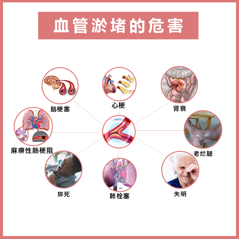 血管淤堵的危害.jpg