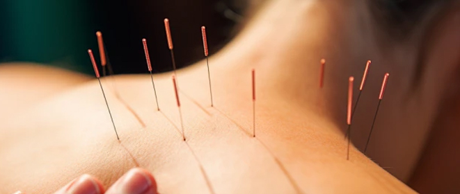 激光光灸和传统针灸的区别与好处有哪些?.jpg 激光光灸和传统针灸的区别与好处有哪些?.jpg